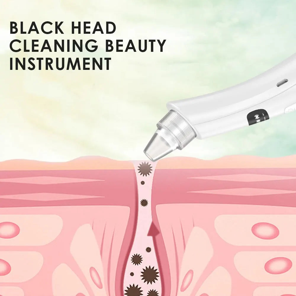 Beauty Machine for Blackhead Removal